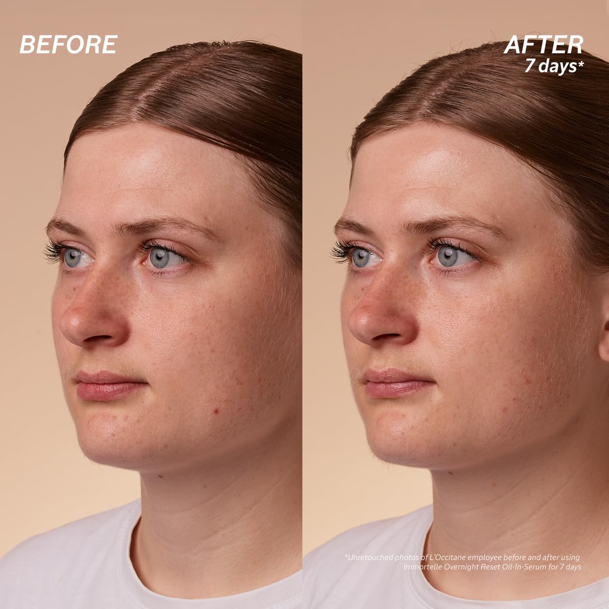 L'Occitane Immortelle Overnight Reset Oil-In-Serum: More Radiant Skin In 1 Night, Smooth Fine Lines, Revitalize Dull Skin, Award-Winner - Image 4