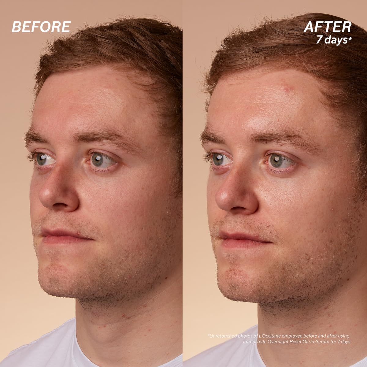 L'Occitane Immortelle Overnight Reset Oil-In-Serum: More Radiant Skin In 1 Night, Smooth Fine Lines, Revitalize Dull Skin, Award-Winner - Image 5