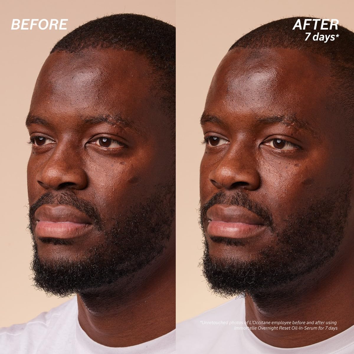 L'Occitane Immortelle Overnight Reset Oil-In-Serum: More Radiant Skin In 1 Night, Smooth Fine Lines, Revitalize Dull Skin, Award-Winner - Image 8