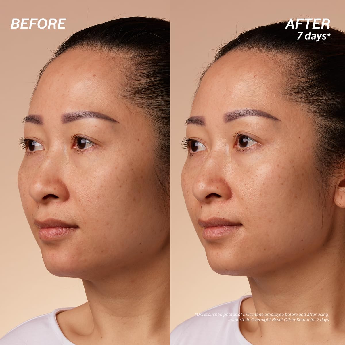 L'Occitane Immortelle Overnight Reset Oil-In-Serum: More Radiant Skin In 1 Night, Smooth Fine Lines, Revitalize Dull Skin, Award-Winner - Image 9